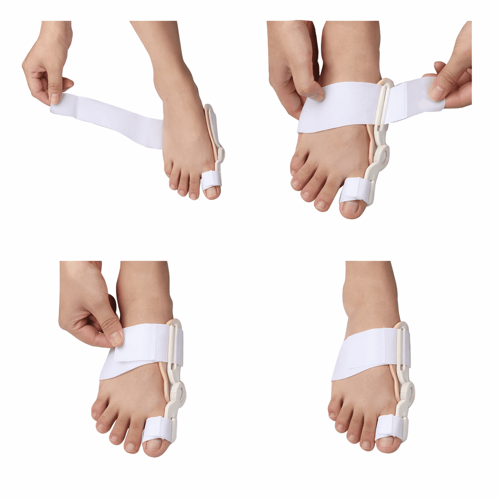 Bunion Corrector مصحح إبهام القدم الطبي لتعديل الاعوجاج وتخفيف الألم، صورة 4